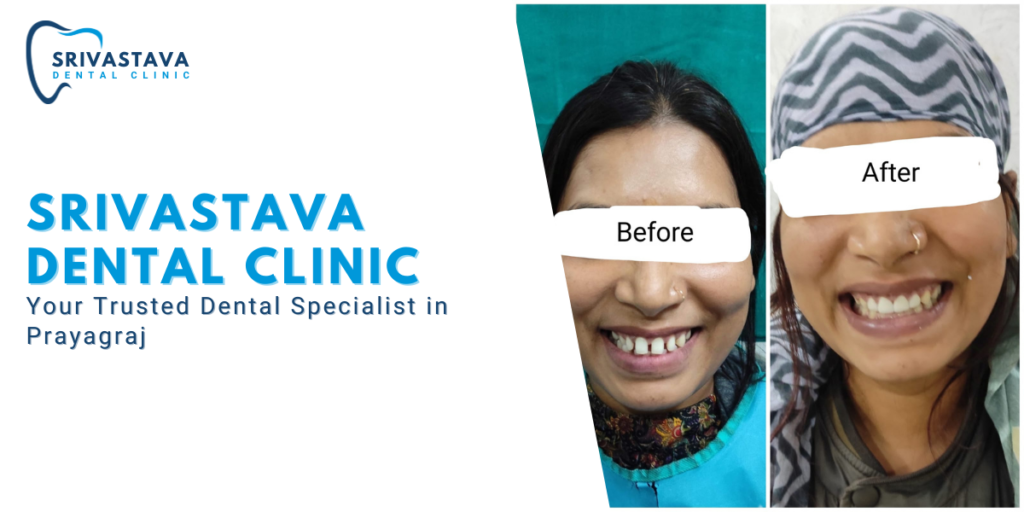 Srivastava Dental Clinic - Your Trusted Dental Specialist in Prayagraj