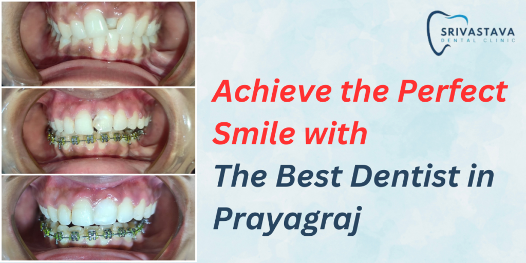 Best Dentist in Prayagraj