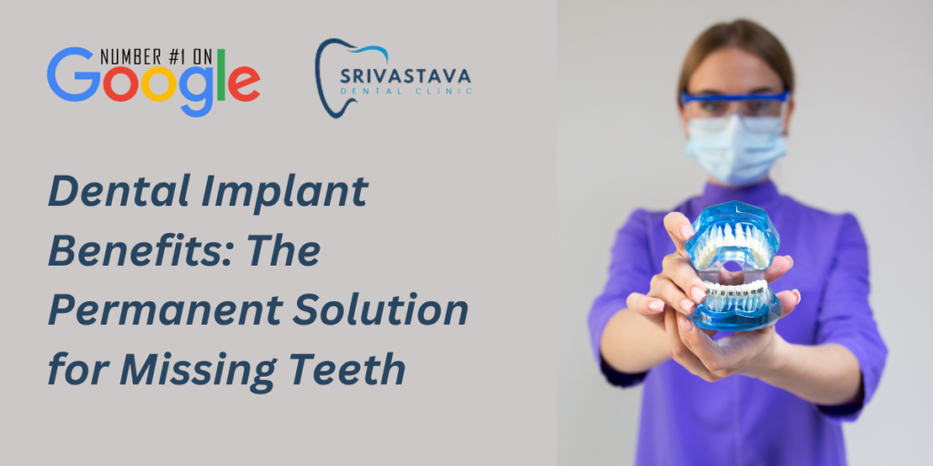 Dental Implant Benefits: The Permanent Solution for Missing Teeth