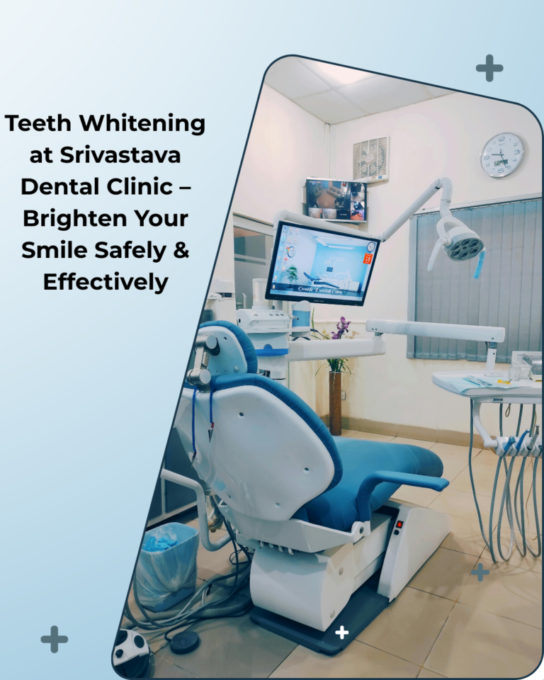 Blogs 45 Teeth Whitening