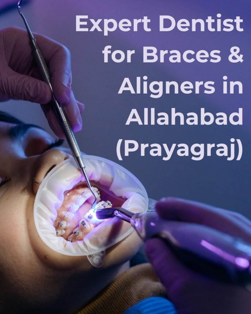 Expert Dentist for Braces & Aligners in Allahabad (Prayagraj)